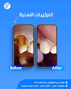 مركز نبض معان الطبي