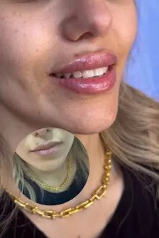 عيادة إلييت كلينك للجلدية والليزر و التجميل فرع سحاب