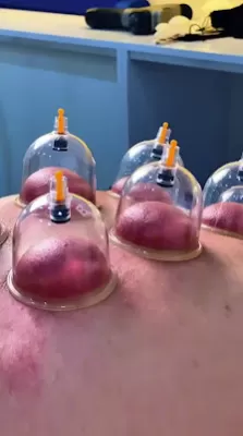مركز الزرقاء الحديث للعلاج الطبيعي