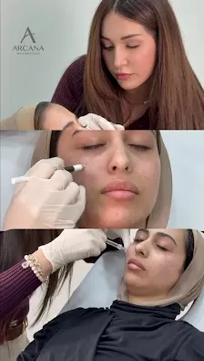 أركانا سنتر(شفا بدران) ليزر ازالة الشعر وتجميل البشرة