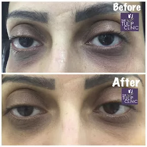 Dr. Zainab Albanna Clinic (The Tulip Clinic) عيادة الدكتورة زينب البنا للأمراض الجلدية والتناسلية و الليزر