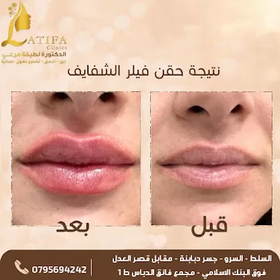 Latifa Clinic - عيادات الدكتورة لطيفة للتجميل والليزر