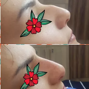 عيادة الدكتورة نيفين دبابنه اخصائية الجلدية والتجميل والعلاج بالليزر
