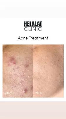 Helalat Clinic