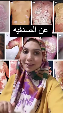 عيادة الدكتورة هدى القضاة للجلدية والتجميل والليزر