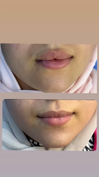 الشايب ايليت للتجميل والليزر
