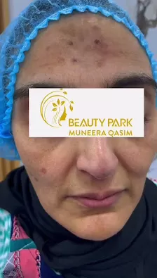 مركز بيوتي بارك منيرة قاسم للعناية بالبشرة والليزر