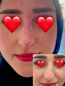 إيڤا كلينك