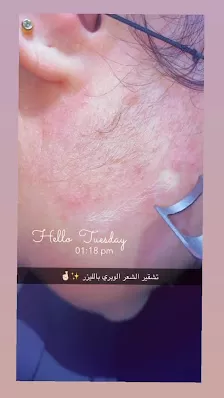عيادة الدكتورة رشا الشناق للامراض الجلدية والليزر