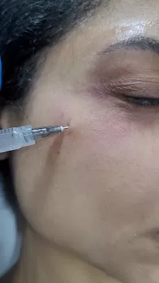 Melo Beauty Clinic
