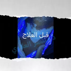 الدكتور منتصر العلاوي
