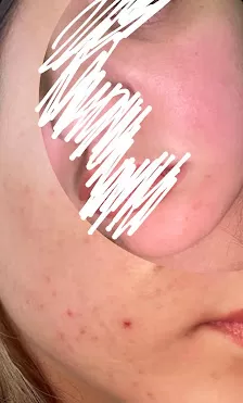 عيادة ايلا للتجميل والليزر