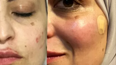 عيادة ايلا للتجميل والليزر