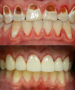 عياده طب الاسنان