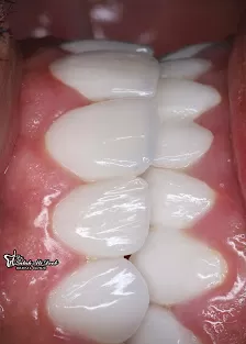 عيادة الدكتور صلاح علي ذيب | طب وجراحة الفم والأسنان