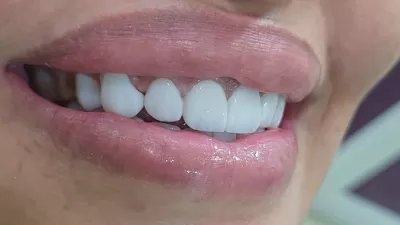 عيادة الدكتور غسان ايمن - طب وجراحة الفم والاسنان