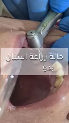 عيادة الدكتور غسان ايمن - طب وجراحة الفم والاسنان