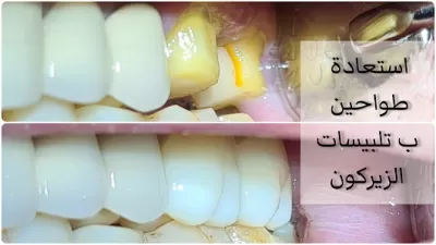 عيادة الدكتور غسان ايمن - طب وجراحة الفم والاسنان