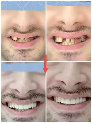 عيادة د. آية حسني السيد طب و جراحة الفم و زراعة اﻷسنان