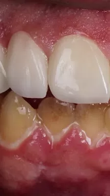 عيادة الدكتورة روان حسن مصطفى لطب و جراحة الفم و الأسنان