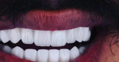 مركز سحاب الحديث لطب وزراعه الاسنان