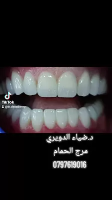 عيادة الدكتور ضياء الدويري للأسنان