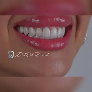 مركز الدكتور خالد الحمارنة لطب الأسنان