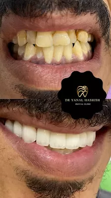 عيادة الدكتور ينال ابو حشيش