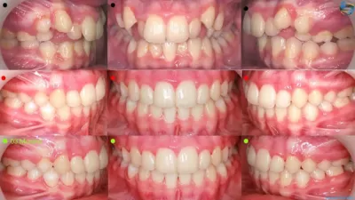 تقويم الأسنان و طب و جراحة الفم و الاسنان