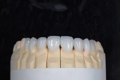 الدكتور بسام الزعبي لطب و زراعة الأسنان