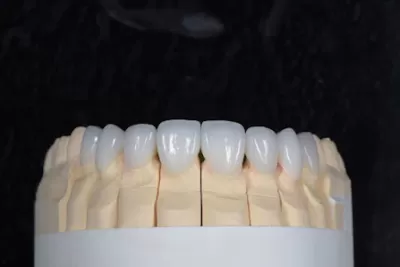 الدكتور بسام الزعبي لطب و زراعة الأسنان