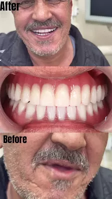 مركز العقرباوي لطب الاسنان . دكتور فراس العقرباوي