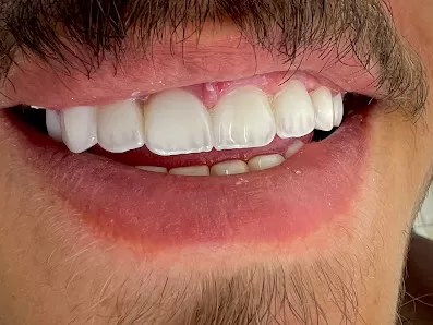 عيادة المشيرفة لطب الاسنان