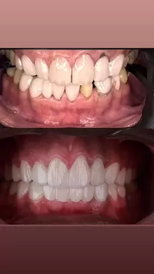 عيادة الدكتورهاشم طلال المعايطة لطب وجراحة الفم والاسنان