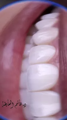 عيادة الدكتورهاشم طلال المعايطة لطب وجراحة الفم والاسنان