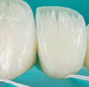 الدكتور حمزة الفقيه لطب وجراحة الفم والاسنان