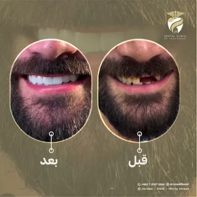 الدكتور عماد الدين ظهيرات طب وجراحه الفم والاسنان