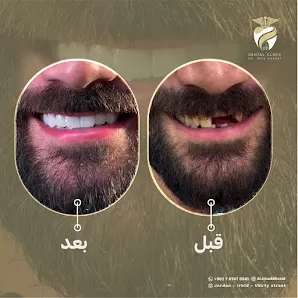 الدكتور عماد الدين ظهيرات طب وجراحه الفم والاسنان