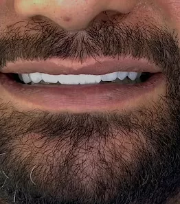 الدكتور عماد الدين ظهيرات طب وجراحه الفم والاسنان