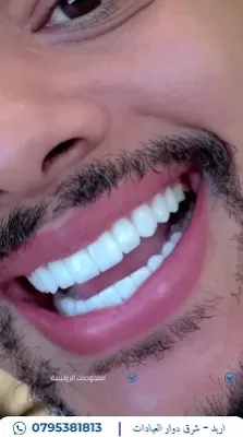 عيادة الدكتور أحمد الظهيرات طب وجراحة الفم والاسنان