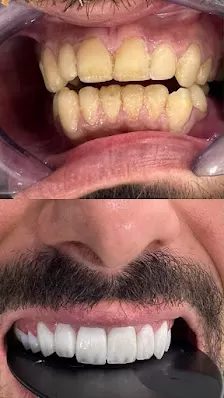 عيادة الدكتور أحمد الظهيرات طب وجراحة الفم والاسنان