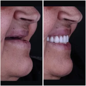 عيادة د. تهاني أبو التين التخصصية لطب و جراحة الفم و الأسنان