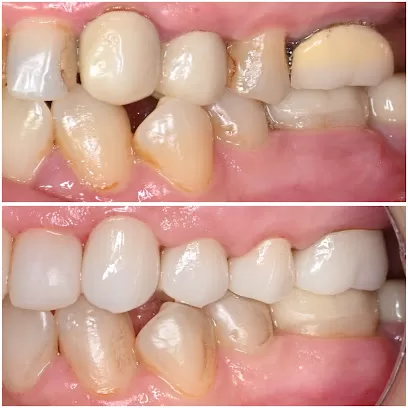 عيادة د. تهاني أبو التين التخصصية لطب و جراحة الفم و الأسنان