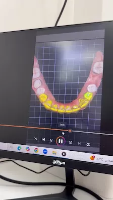 عيادة الدكتورة نداء خنجر / طب وزراعة الاسنان