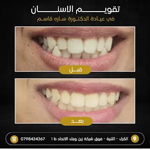 عيادة الدكتورة ساره قاسم