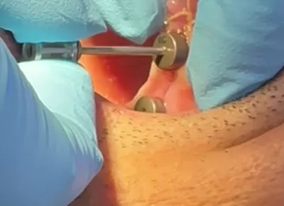 الدكتورة ربا القيسي لطب وزراعة الاسنان