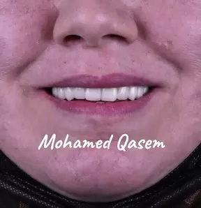 مركز الدكتور محمد الحاج قاسم لطب و زراعة الاسنان