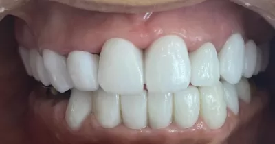 عيادة اسنان الدكتور يزن اليبرودي