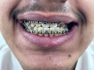 عيادة اسنان الدكتور يزن اليبرودي