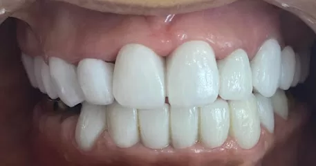 عيادة اسنان الدكتور يزن اليبرودي